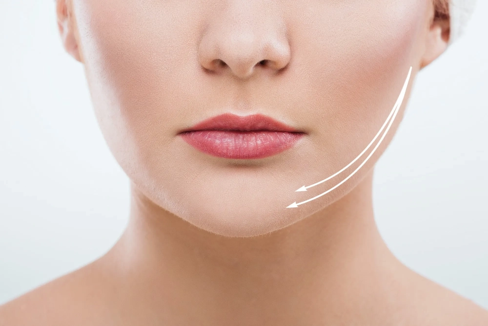 如何根據不同雙下巴成因選擇適合的醫美療程？